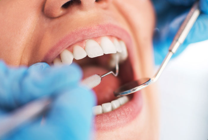 Stock image of a female patient being tested using dental equipment