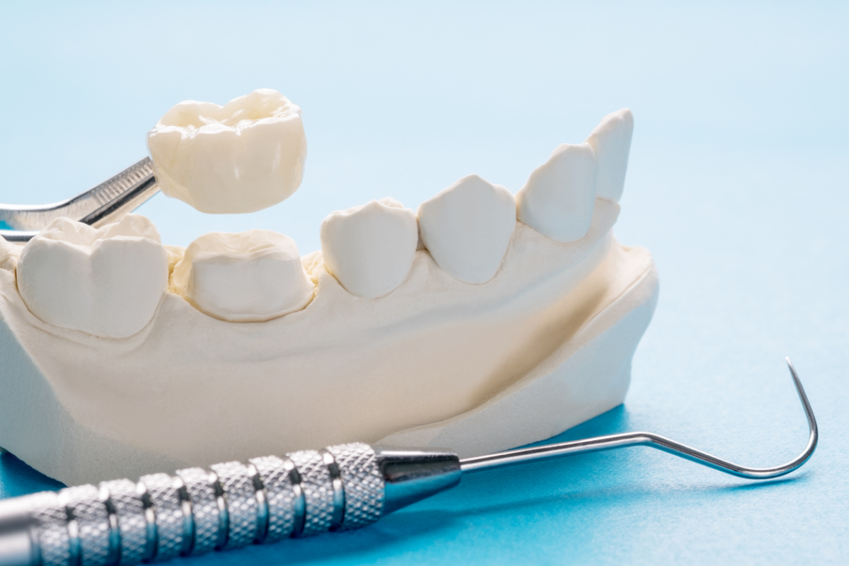 Featured image for Is Getting a Dental Crown Painful